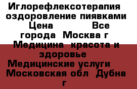 Иглорефлексотерапия, оздоровление пиявками › Цена ­ 3 000 - Все города, Москва г. Медицина, красота и здоровье » Медицинские услуги   . Московская обл.,Дубна г.